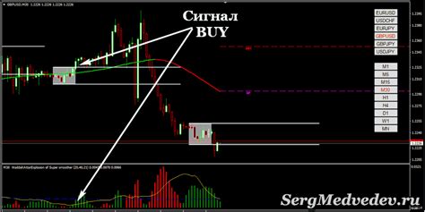 внутридневная форекс 20 пипсов